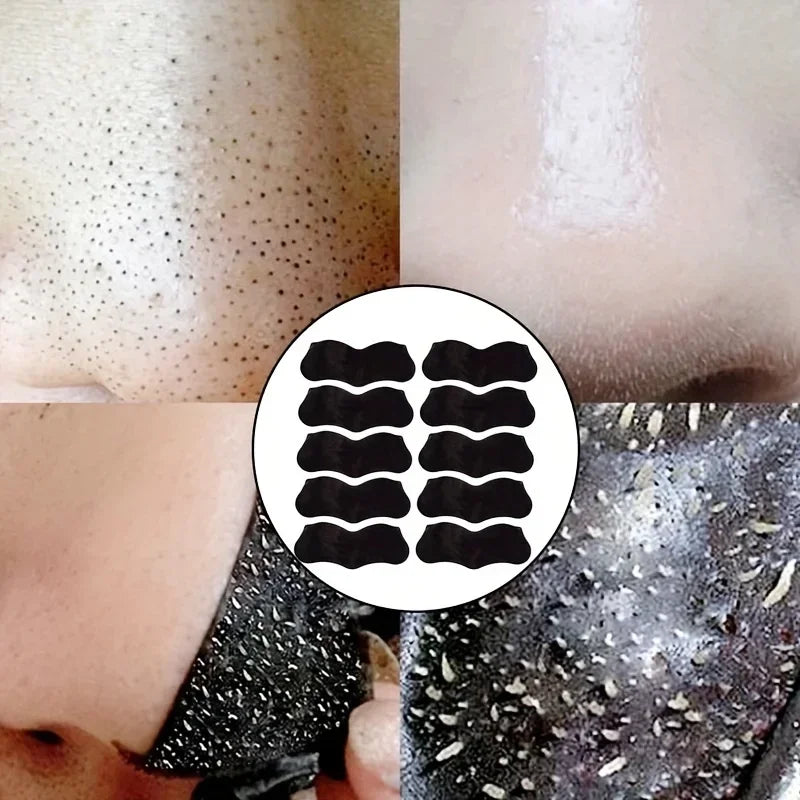 15 Patchs Anti-Points Noirs – Nettoyage en Profondeur du Nez, Masque Purifiant pour Peau à Imperfections et Acné (Idéal Dropshipping)